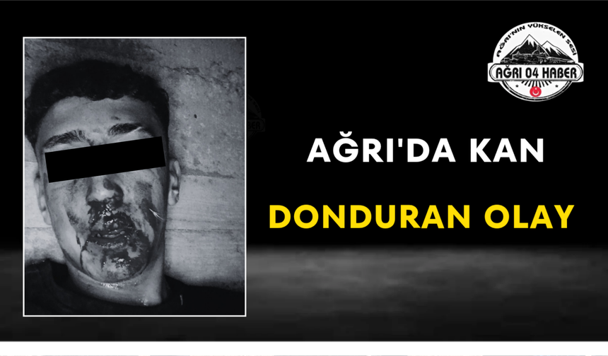 Ağrı'da Kan Donduran Olay